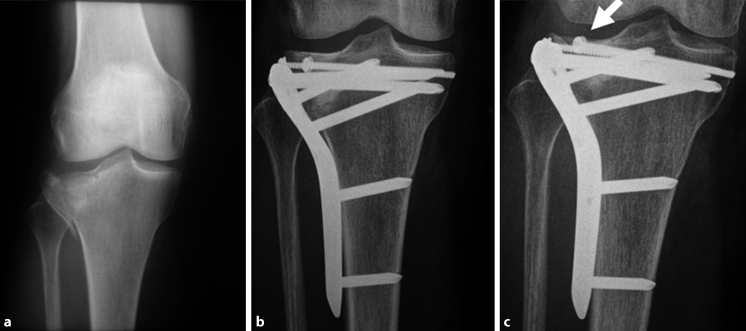Spezifische Behandlungsstrategien Springerlink