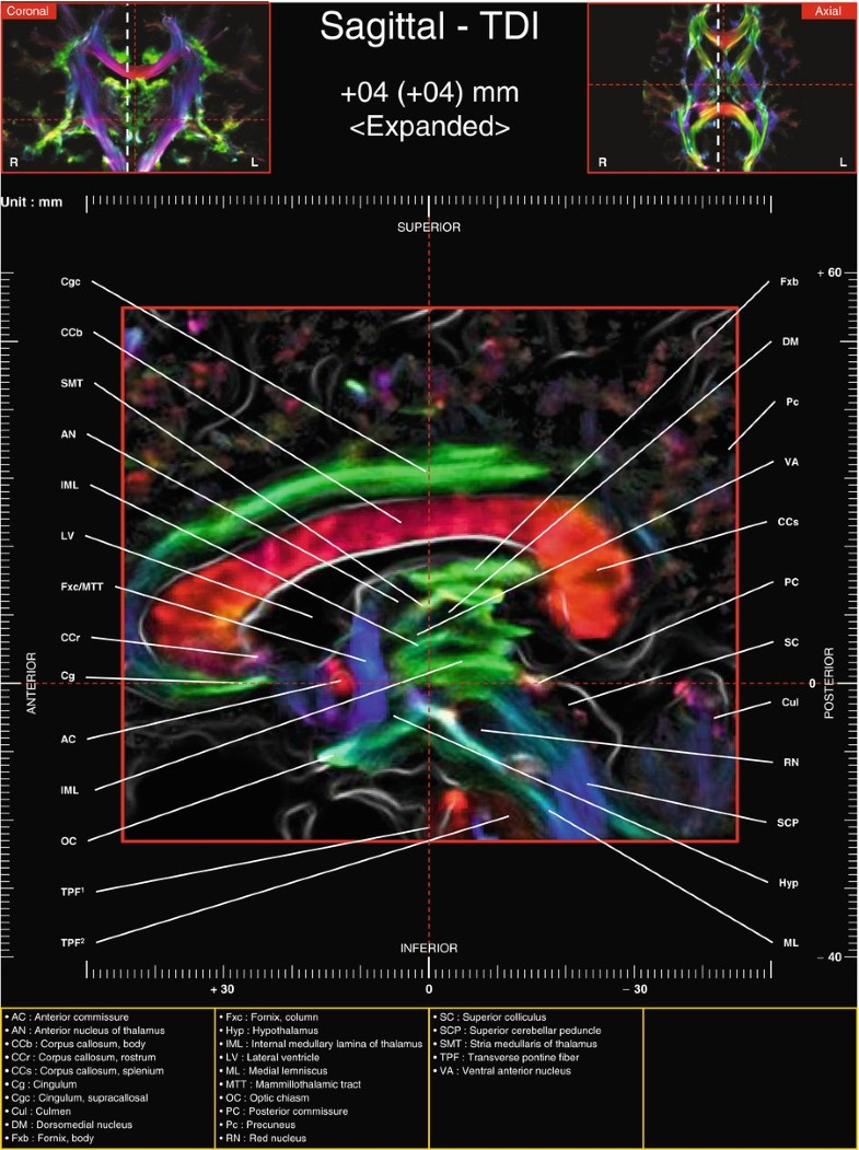 Sagittal Images Of Tractography And Corresponding In Vivo 7 0 T Mri Anatomy Springerlink