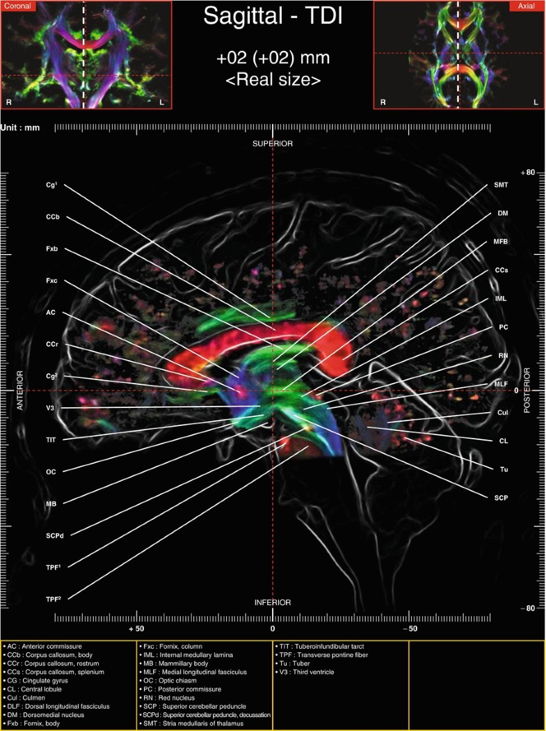 Sagittal Images Of Tractography And Corresponding In Vivo 7 0 T Mri Anatomy Springerlink
