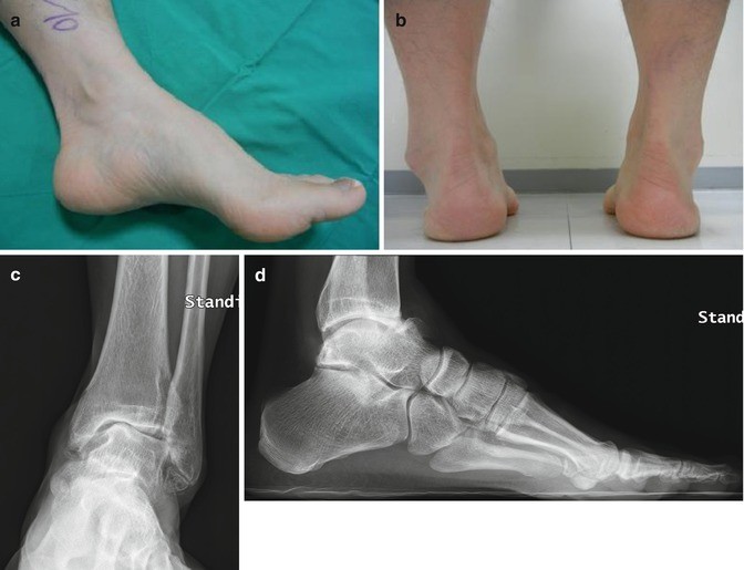 Solarium, harm and benefit from his visit Solarium, harm and benefit from his visit