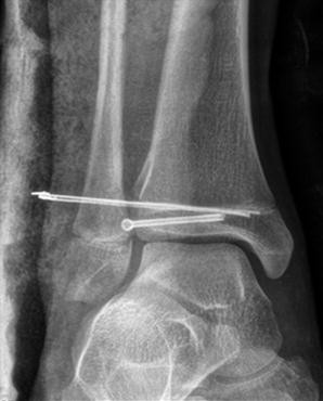 Salter Orthopedics Ebook Salter Orthopedics Ebook