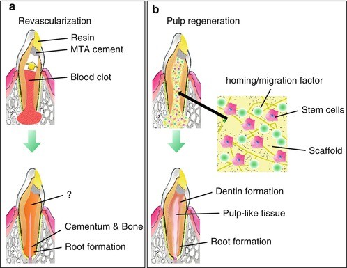 pulp regeneration revascularization approaches vivo experimental fig protocol
