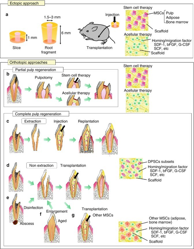 Experimental In Vivo Approaches of Pulp Regeneration | SpringerLink