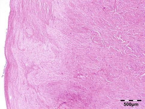 The Orbit, Including the Lacrimal Gland and Lacrimal Drainage System | SpringerLink
