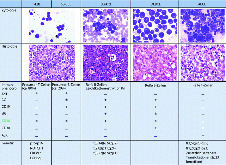 Leukämien und Lymphome | SpringerLink