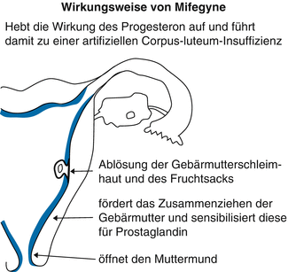 Ungewollte Schwangerschaft | SpringerLink