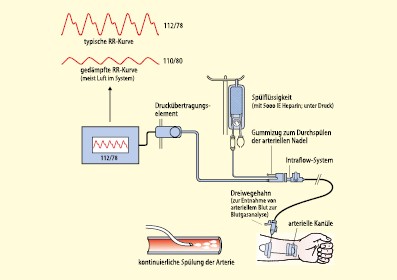 Monitoring in Narkose und Intensivmedizin | SpringerLink