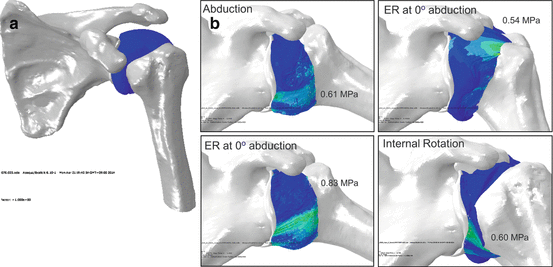Pathomechanics of Frozen Shoulder A Basic Research Perspective