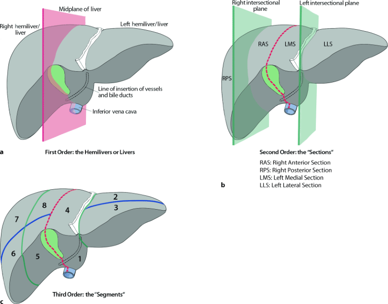 Terminology of Liver Anatomy and Resections: The Brisbane ...