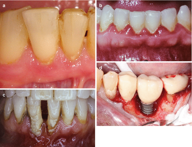 Fundamentals Springerlink