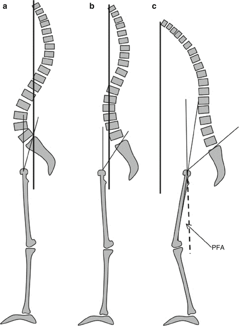 Анатомический матрас spine balance