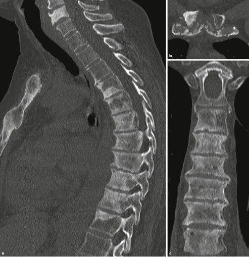 Erkrankungen Der Gelenke Springerlink