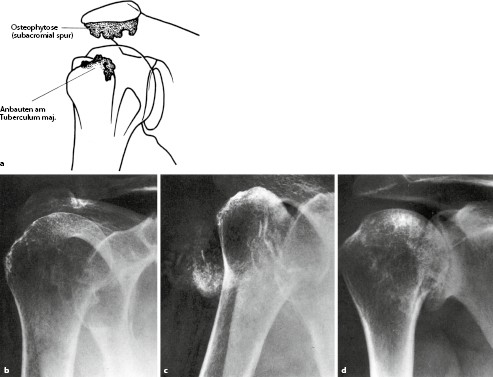 Erkrankungen Der Gelenke Springerlink