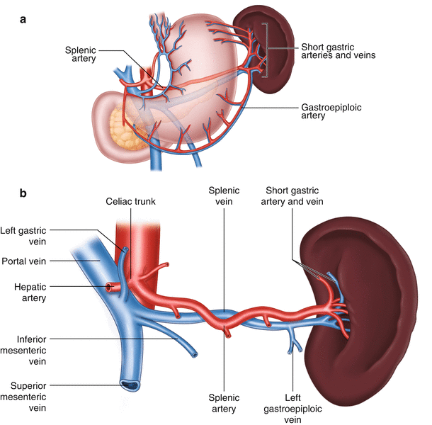 Laparoscopic Splenectomy Springerlink