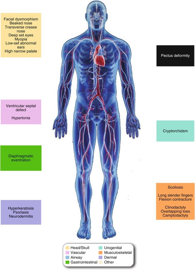 aorta aneurysma hipertónia)