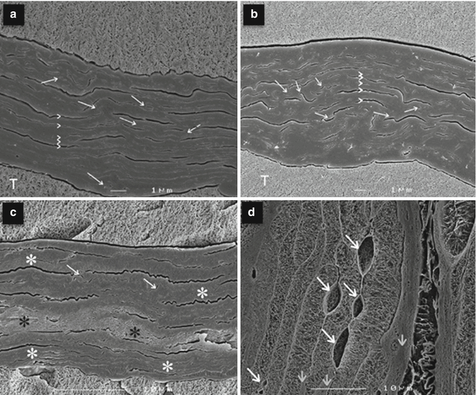 Non Formulation Parameters That Affect Penetrant Skin Vehicle Interactions And Percutaneous Absorption Springerlink