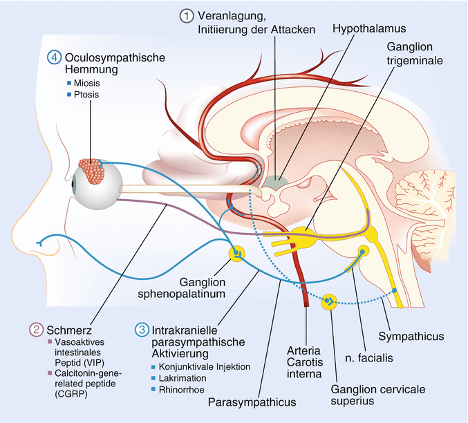 Chirurgische Therapie Von Kopfschmerzen Springerlink