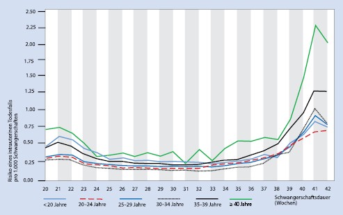 Ultraschall Bei Terminuberschreitung Und Ubertragung Springerlink