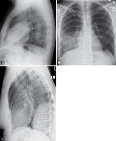 Respiratorisches System Springerlink