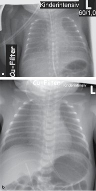 Padiatrie Springerlink