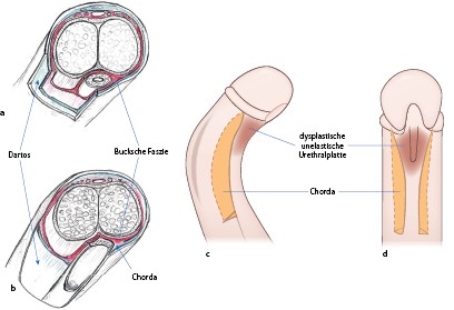 Zu folgen frenulum kurz Frenulum ganz