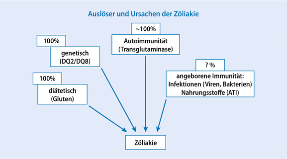 Zoliakie Springerlink