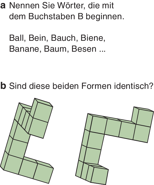 Männliches und weibliches Gehirn | SpringerLink