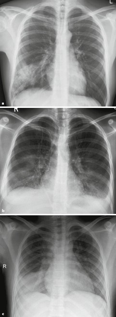 Pneumologie interdisziplinär | SpringerLink