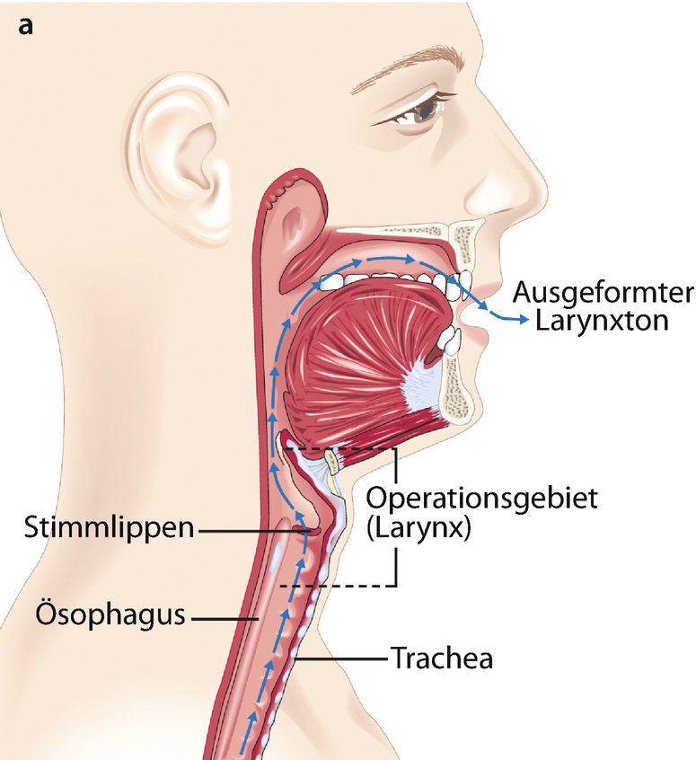 Postoperative Phase | SpringerLink