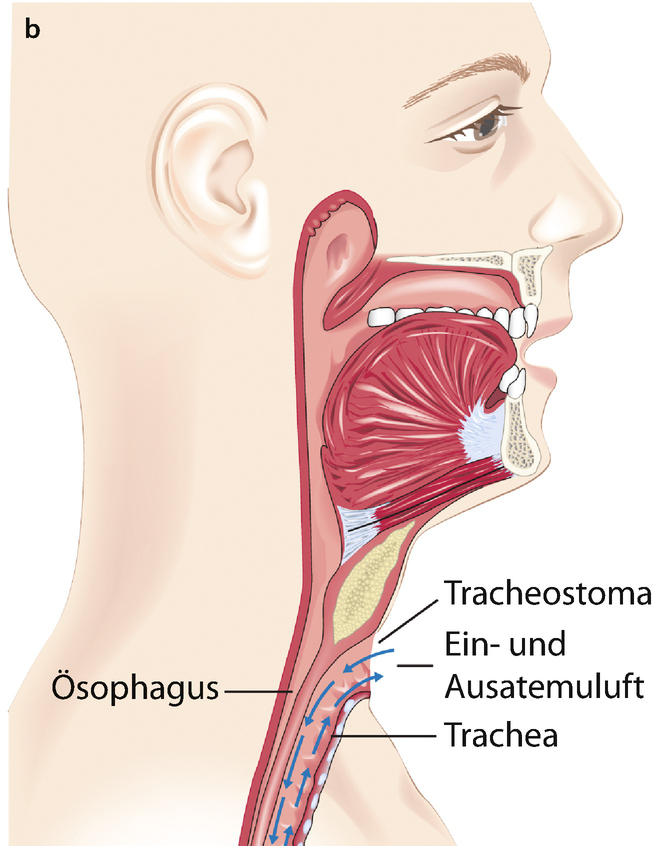 Postoperative Phase | SpringerLink