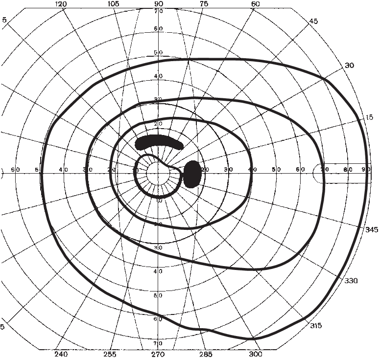 Untersuchungsmethoden Des Ophthalmologen Springerlink