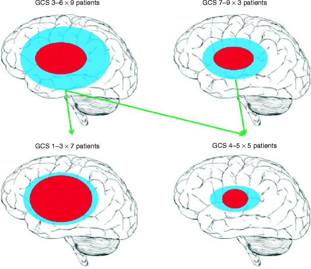 Neuromonitoring with Microdialysis in Severe Traumatic