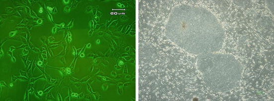 Feeder Cell Sources And Feeder Free Methods For Human Ips Cell