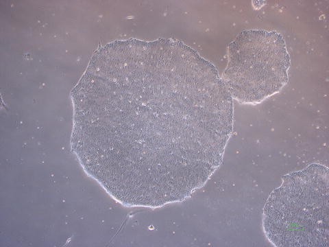 Feeder Cell Sources And Feeder Free Methods For Human Ips Cell