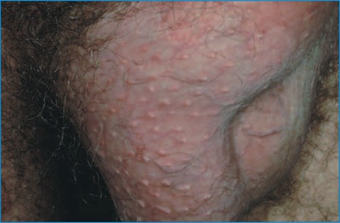 Dysembrioplastic Disorders Springerlink