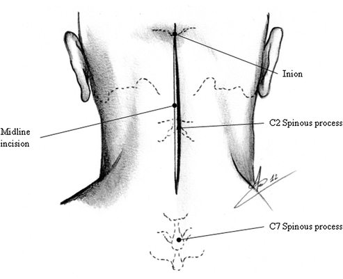 Surgical Approaches 