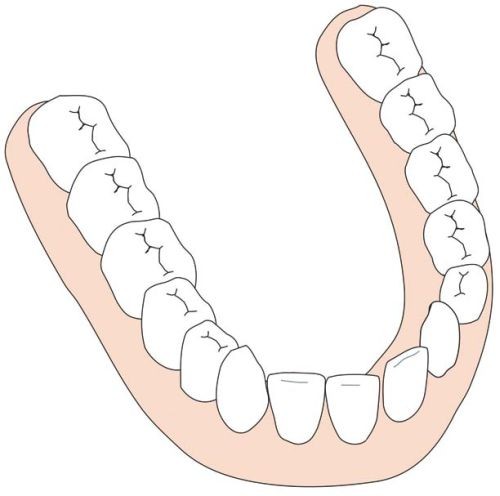 H2 Problemen En Hun Oplossingen Springerlink