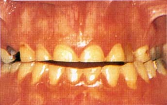 H2 Problemen En Hun Oplossingen Springerlink