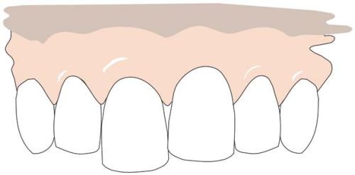 H2 Problemen En Hun Oplossingen Springerlink