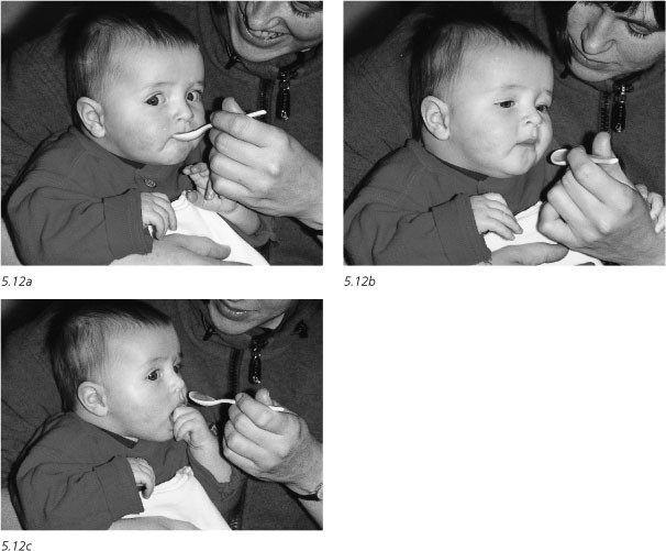 De Ontwikkeling Van De Mond Tongen Keelmotoriek Springerlink