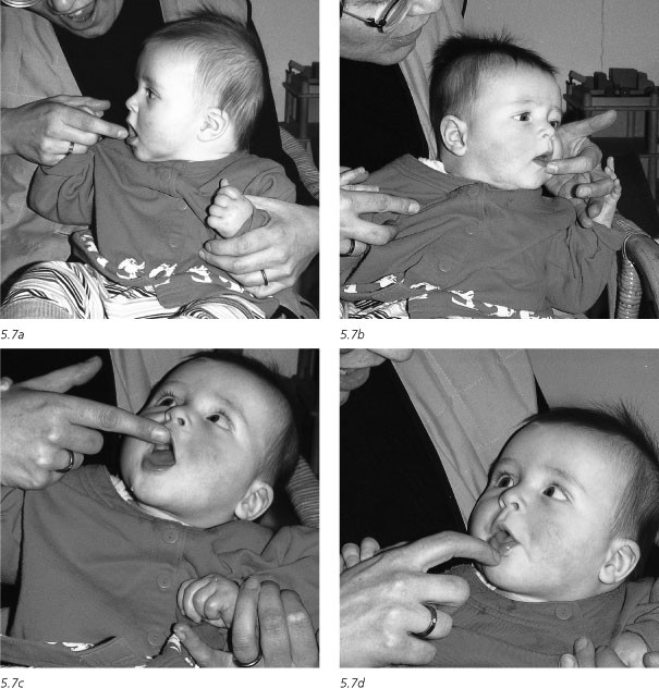 De Ontwikkeling Van De Mond Tongen Keelmotoriek Springerlink