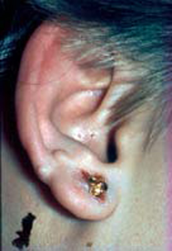 Jongens krijgen piercings in hun oren