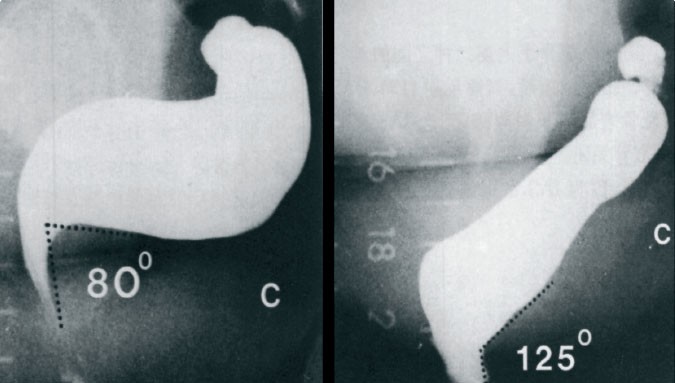 Anorectum Springerlink