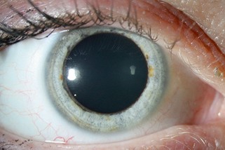 Organisatie Instrumentarium En Onderzoek Ten Behoeve Van De Oogheelkundige Patient In De Huisartspraktijk Springerlink