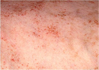 3 Medische Anamnese Risicobepaling En Preventie Springerlink