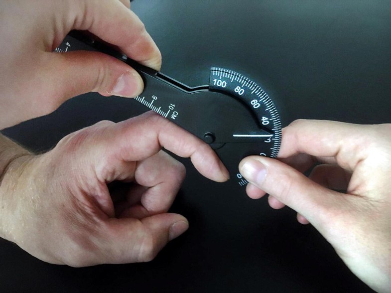 Mallet Finger Springerlink