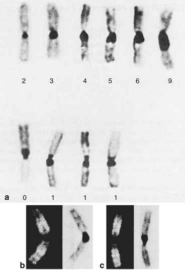 Chromosome 1 | SpringerLink