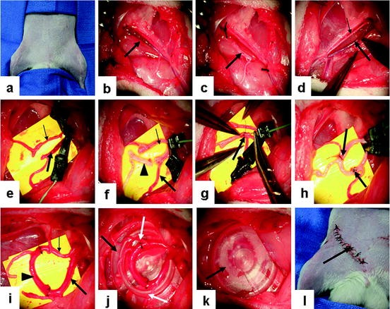 Skin Flap Models For Assessment Of Angiogenesis Springerlink - 