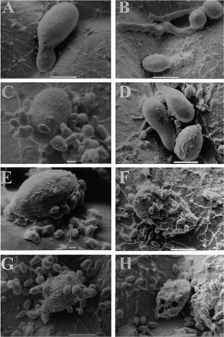 Mechanisms Of Action Of Fungal Biological Control Agents | SpringerLink