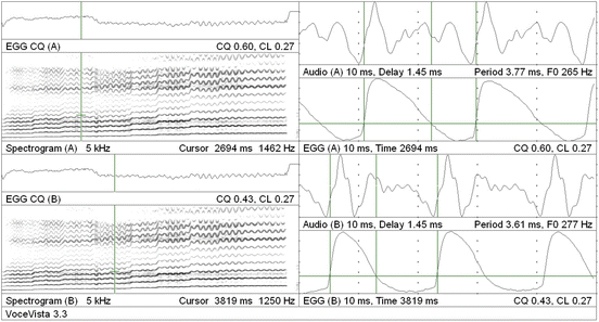 Registers Defined Through Visual Feedback Springerlink Registers Defined Through Visual Feedback Springerlink